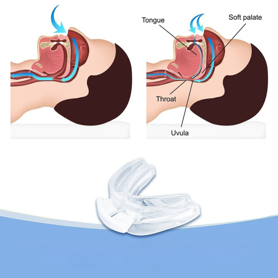 Dev VitalSleep Anti-Snoring