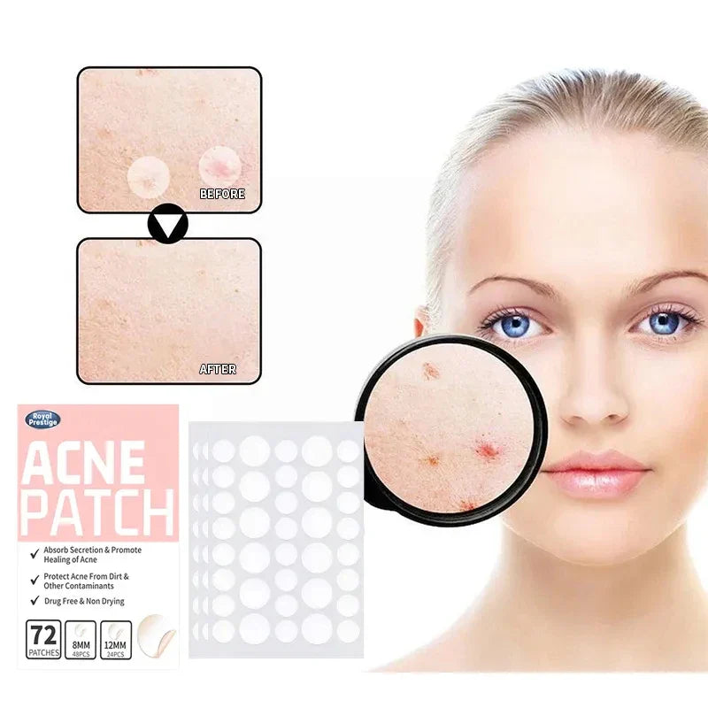 72Pcs Invisible Pimple Removal Acne Patches